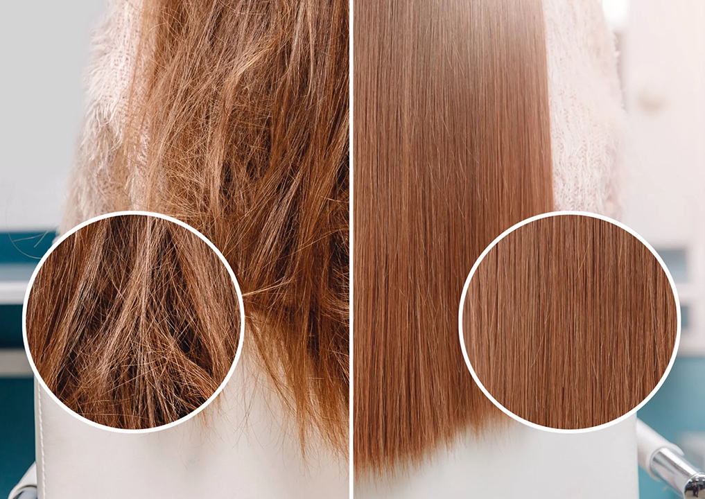 برطرف کردن موخوره