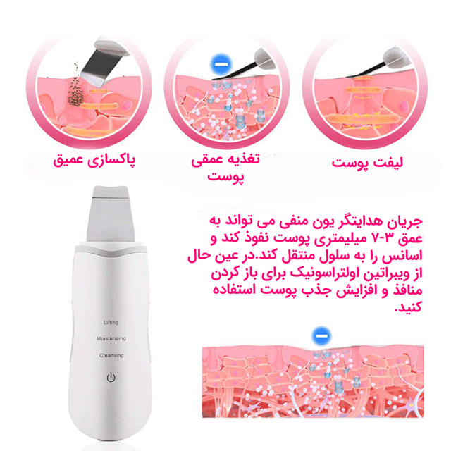 نحوه عملکرد اتو صورت